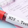 Nigeria Records 20,838 New HIV Infections in Q1 2026 as Health Gaps Persist — Akelicious