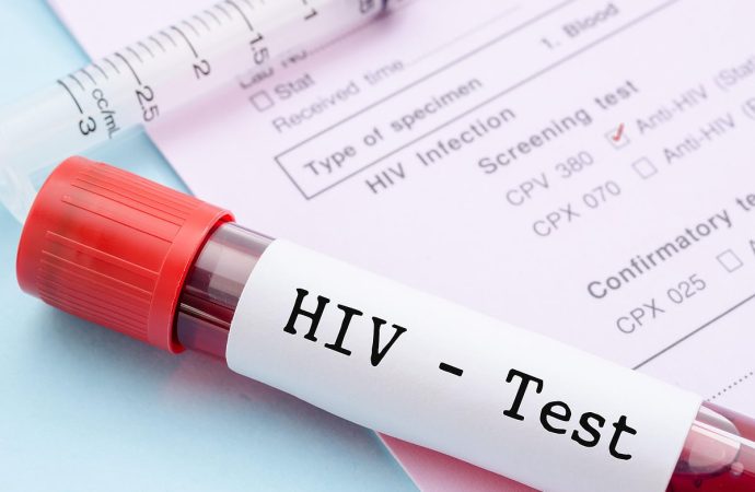 Nigeria Records 20,838 New HIV Infections in Q1 2026 as Health Gaps Persist — Akelicious