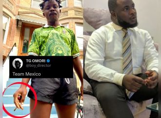 A Kidney Transplant Patient Shouldn’t Be Smoking — Dr Sina Reacts to TG Omori Photo — Akelicious