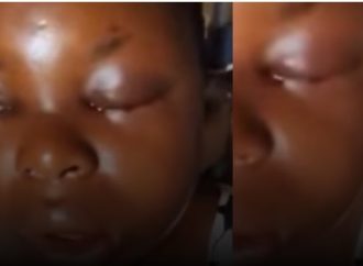 Pregnant Woman Hospitalized After Alleged Assault by Husband in Anambra — Akelicious